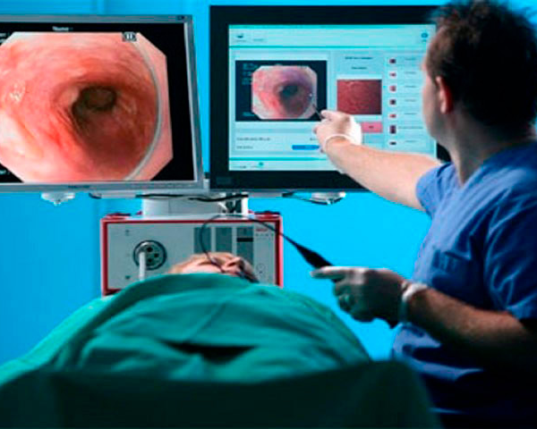 Endoscopia e as principais indicações
